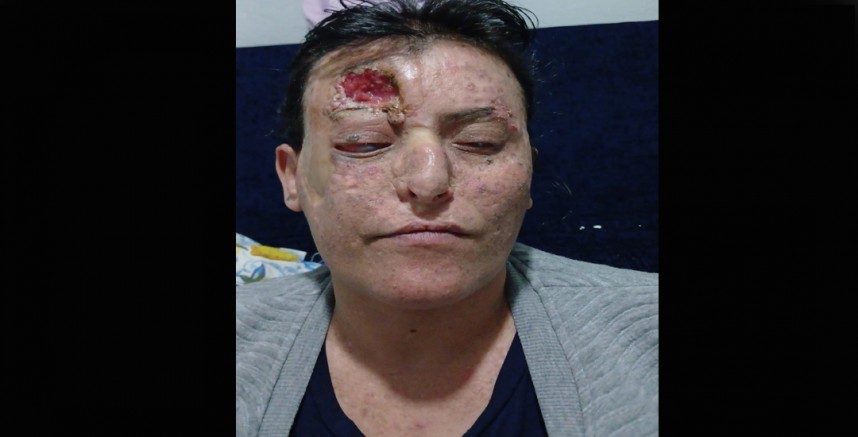 DİYARBAKIR’DA BİR ANNE YAŞAM MÜCADELESİ VERİYOR: “TEK İSTEĞİM ÇOCUKLARIM İÇİN YAŞAYABİLMEK”