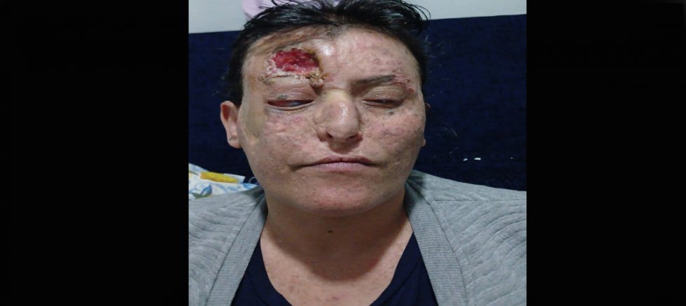 DİYARBAKIR’DA BİR ANNE YAŞAM MÜCADELESİ VERİYOR: “TEK İSTEĞİM ÇOCUKLARIM İÇİN YAŞAYABİLMEK”