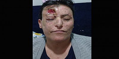 DİYARBAKIR’DA BİR ANNE YAŞAM MÜCADELESİ VERİYOR: “TEK İSTEĞİM ÇOCUKLARIM İÇİN YAŞAYABİLMEK”