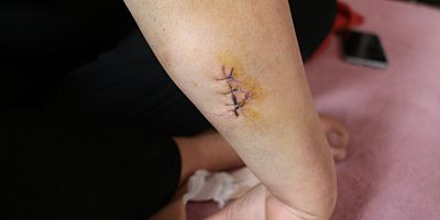 Kocası tarafından 30 yerinden bıçaklandı, görümcesi şikayetini geri çekmesini istedi